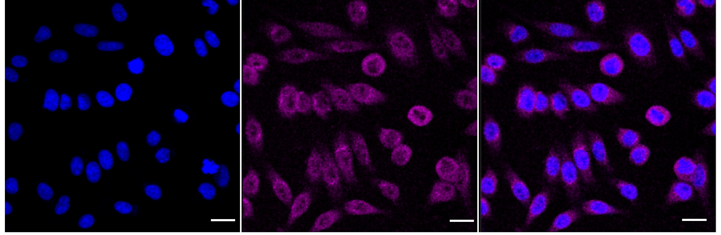 alcohol dehydrogenase 5 Antibody (24GB4695)