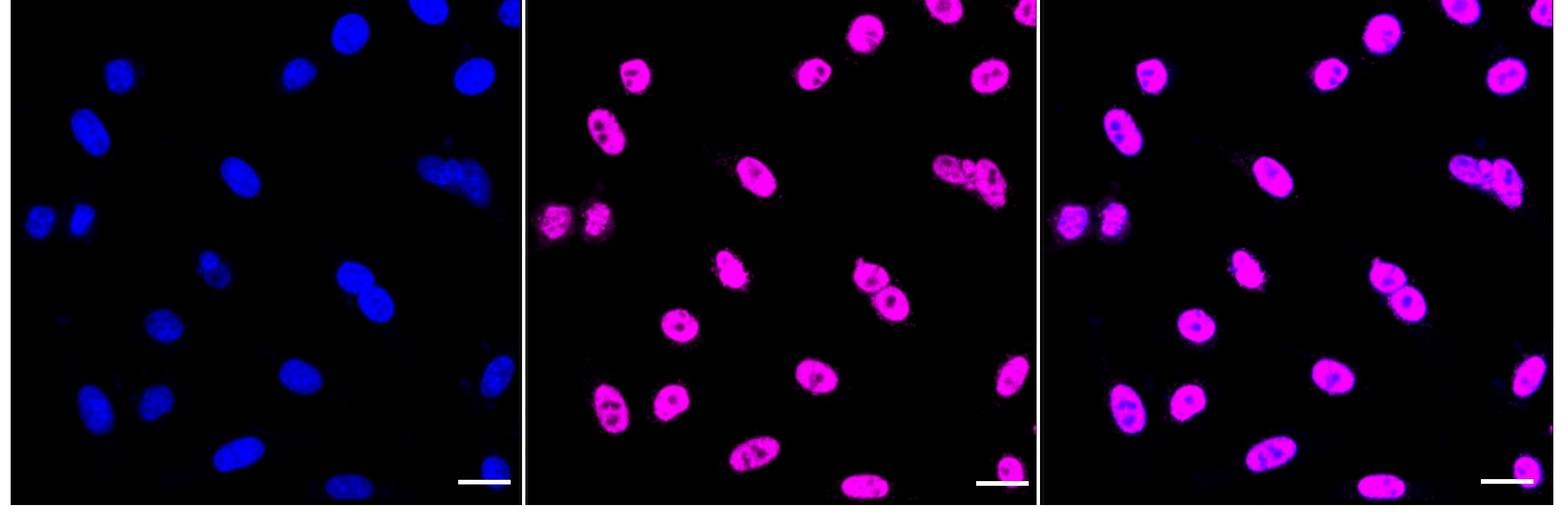 EWSR1 Antibody (24GB4830)