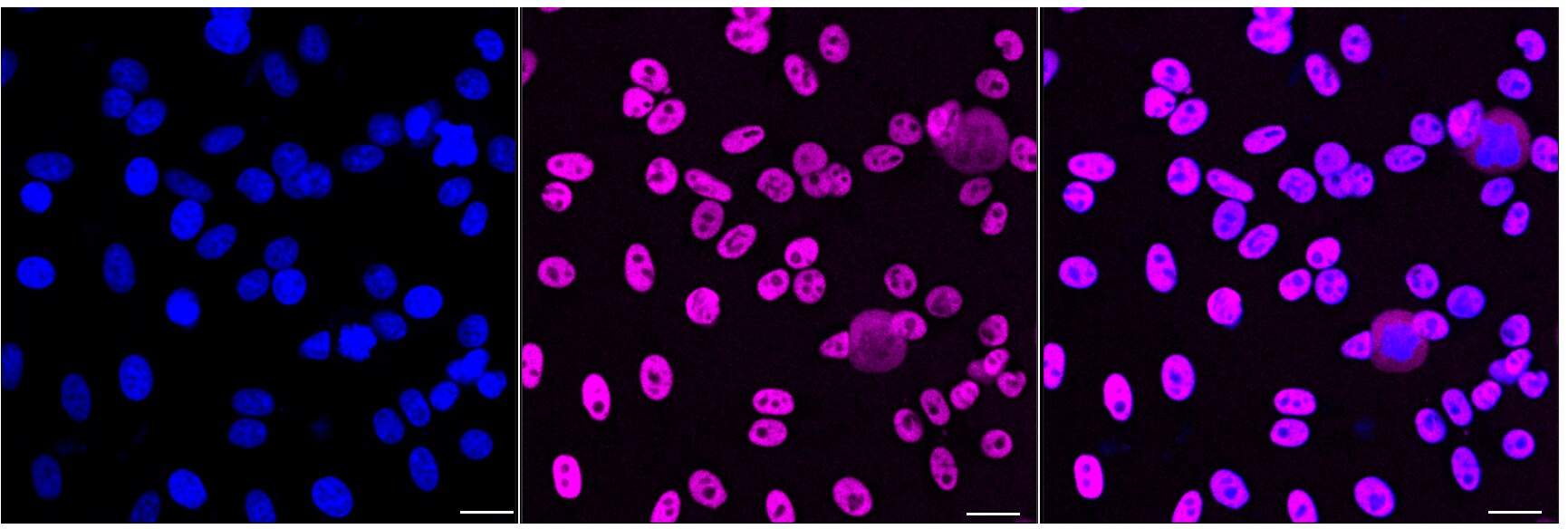 Histone Deacetylase 2/HDAC2 Antibody (24GB4885)