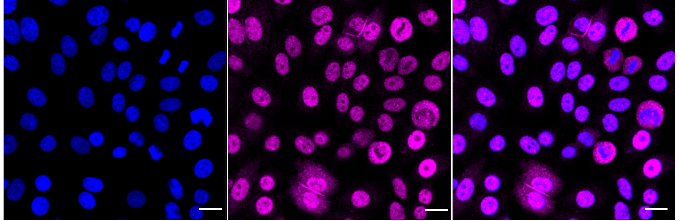 HIPK2 Antibody (24GB4890)