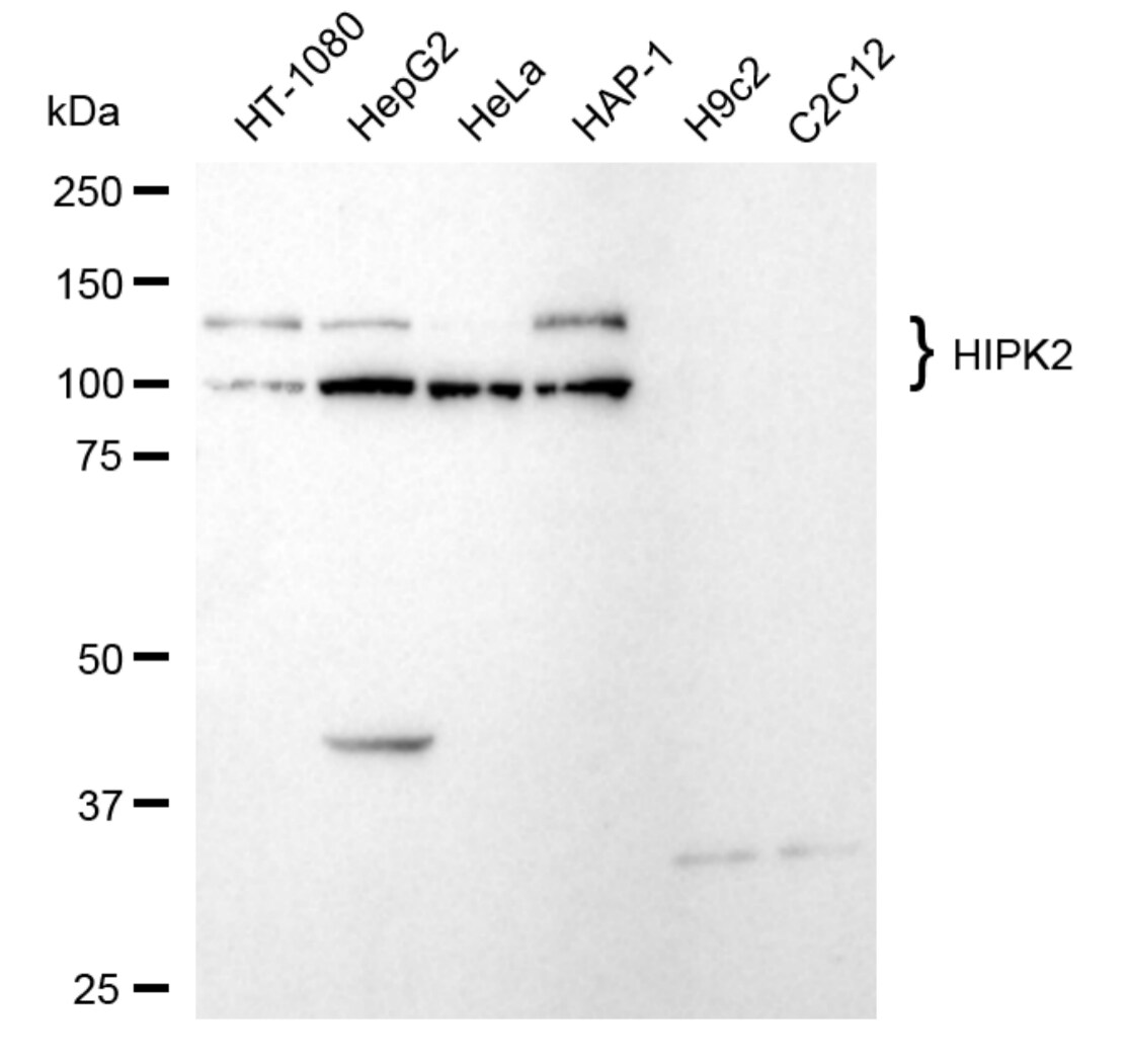 HIPK2 Antibody (24GB4890)