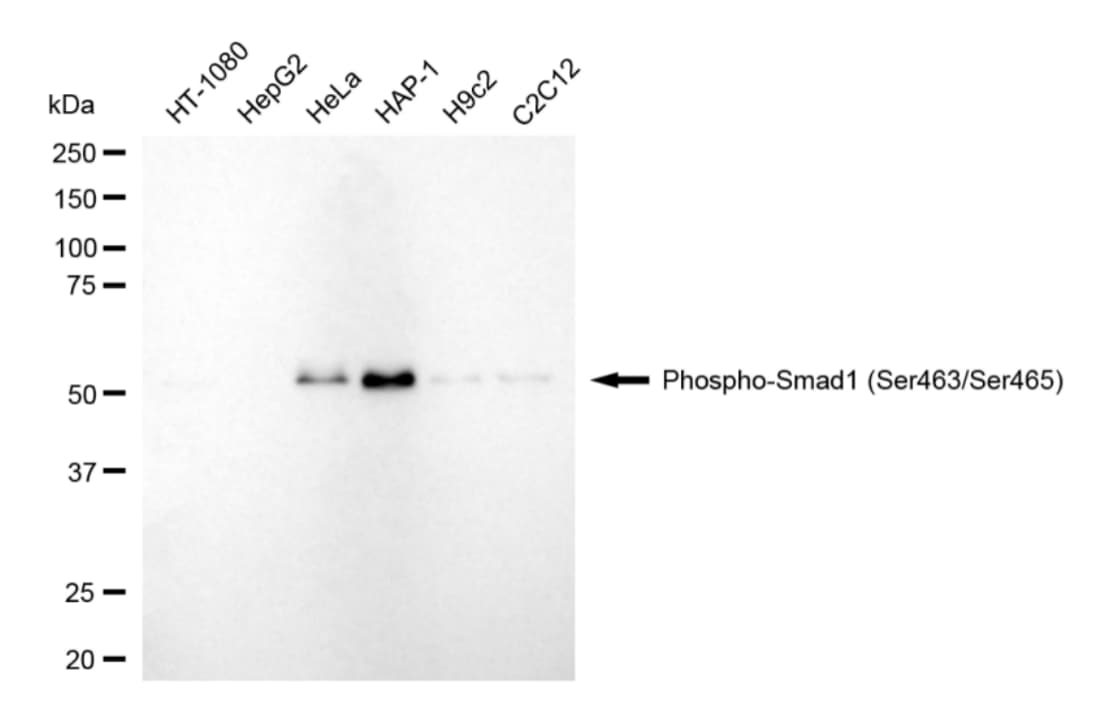 Smad1 [p Ser465] Antibody (24GB5090)