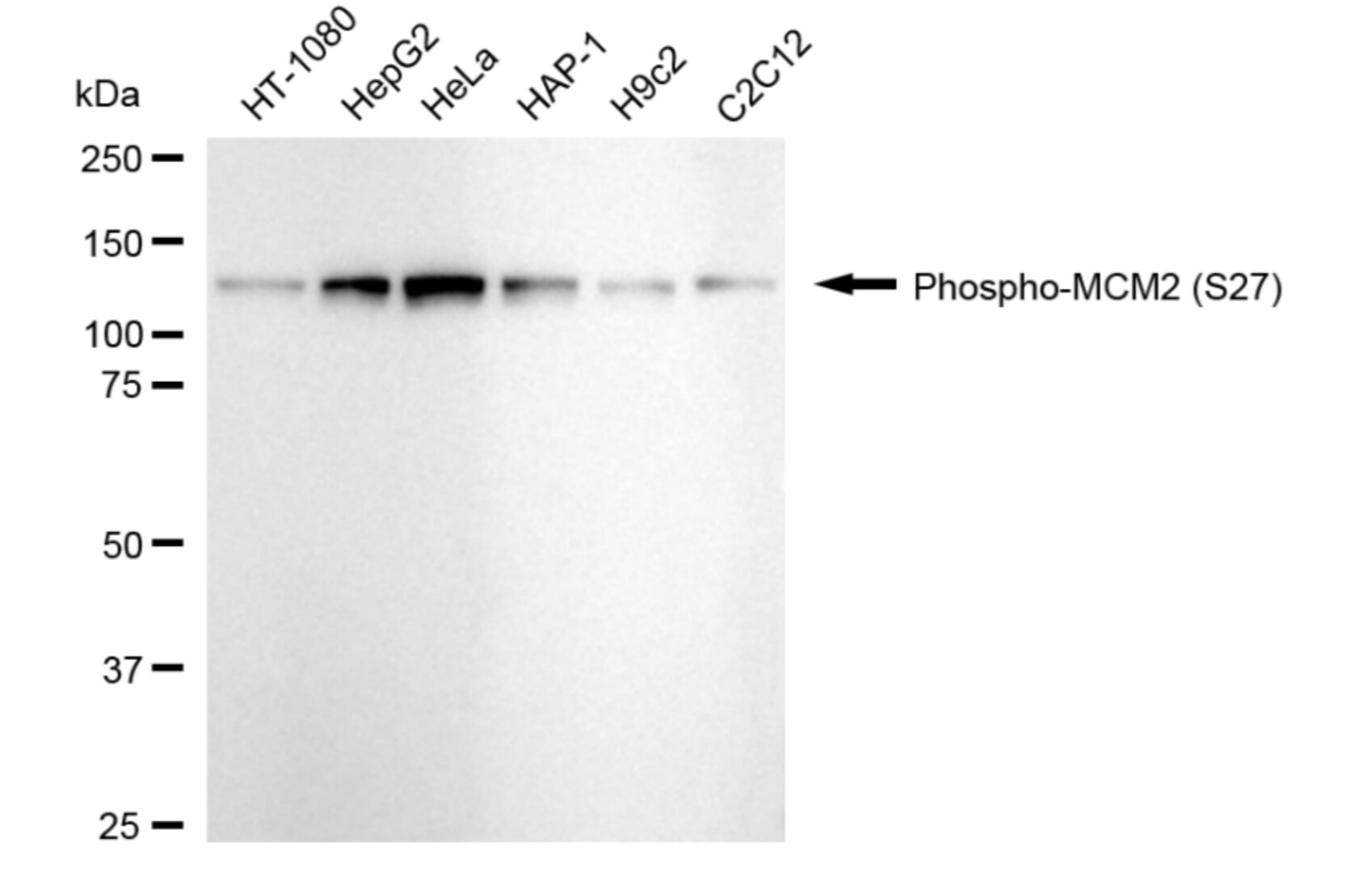MCM2 [p Ser27] Antibody (24GB5180)