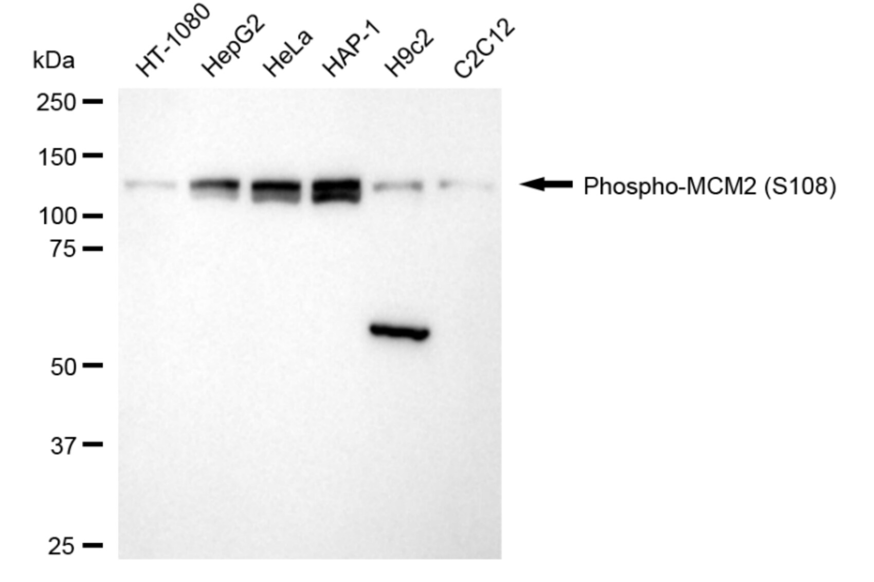 MCM2 [p Ser108] Antibody (24GB5185)