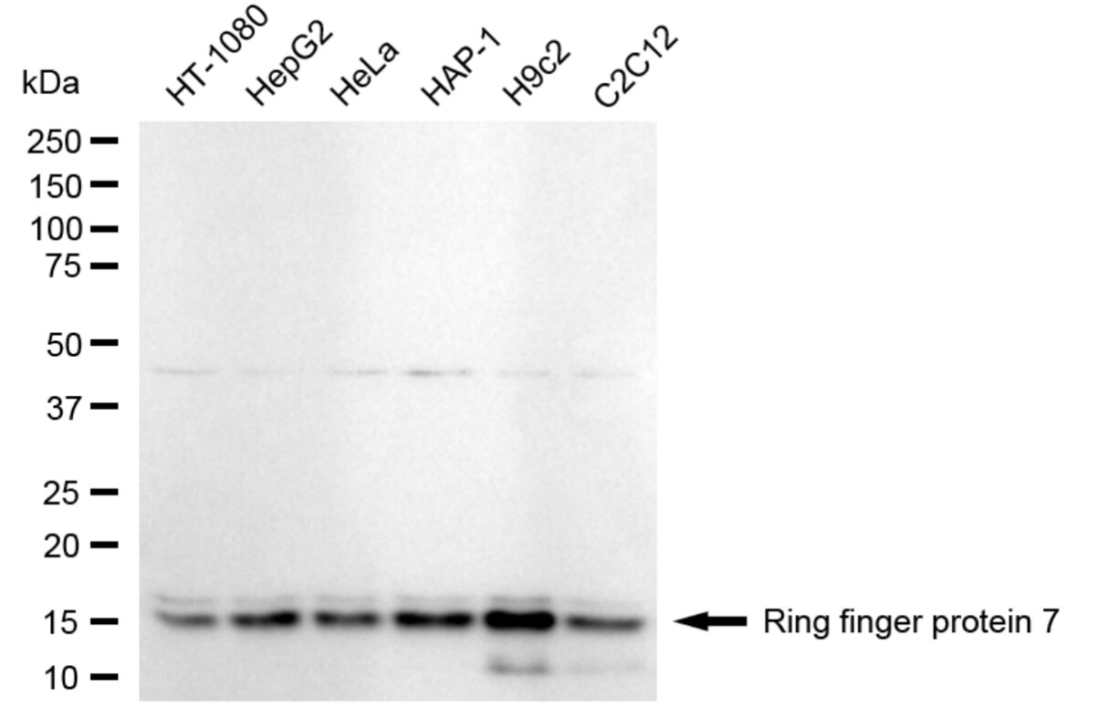 RNF7 Antibody (24GB5200)