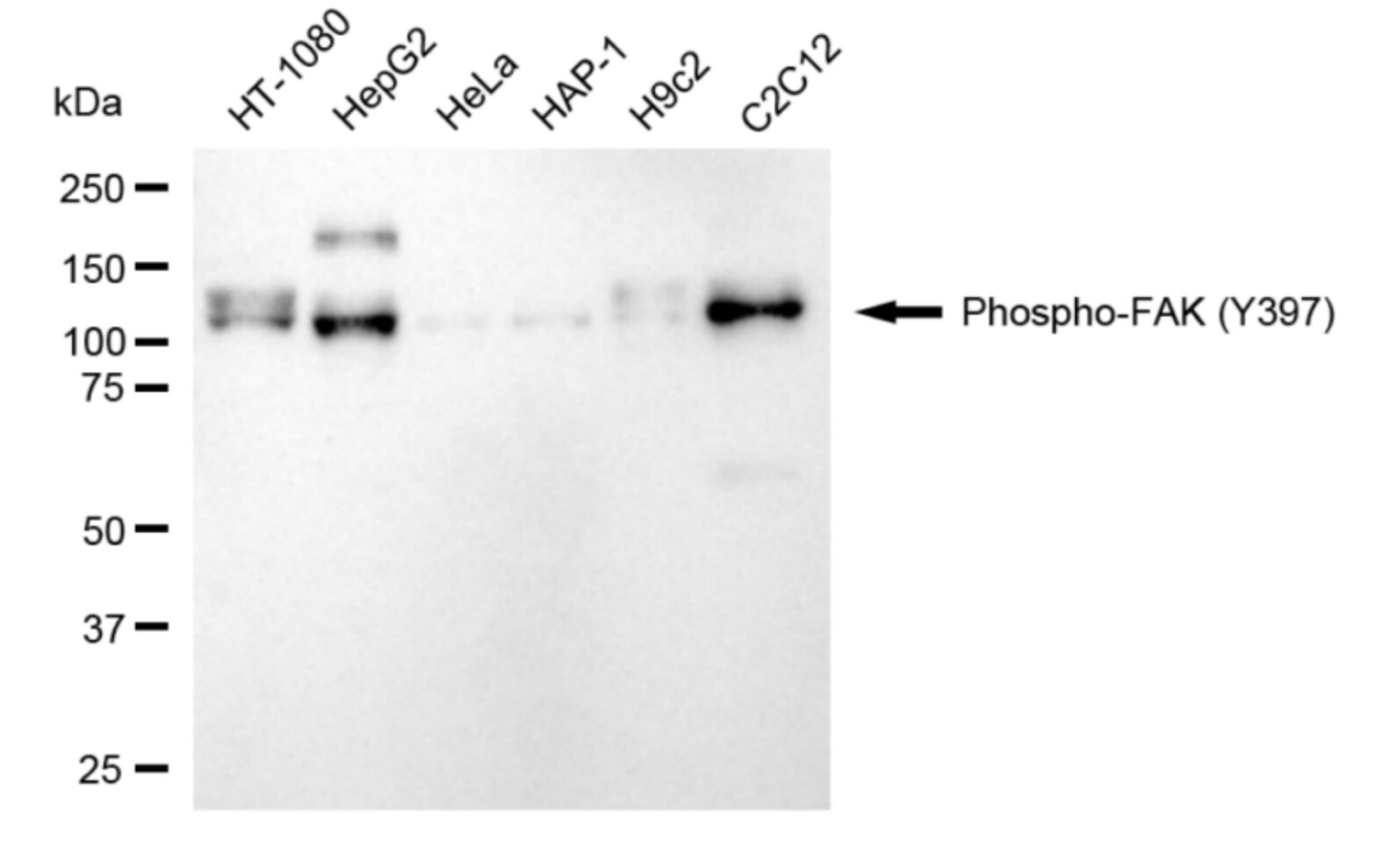 FAK [p Tyr397] Antibody (24GB5215)