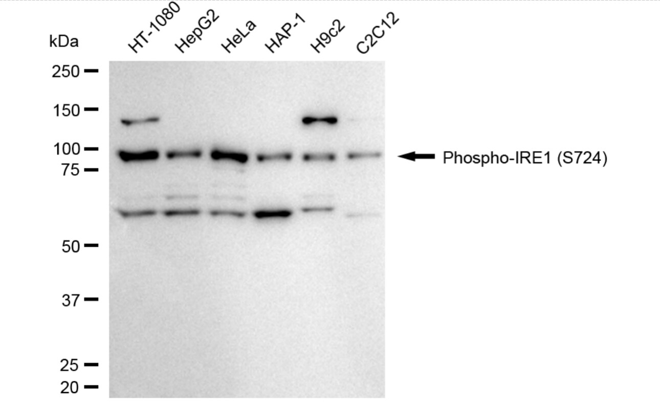 IRE1 [p Ser724] Antibody (24GB5220)