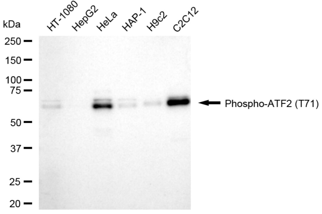 ATF2 [p Thr71] Antibody (24GB5225)