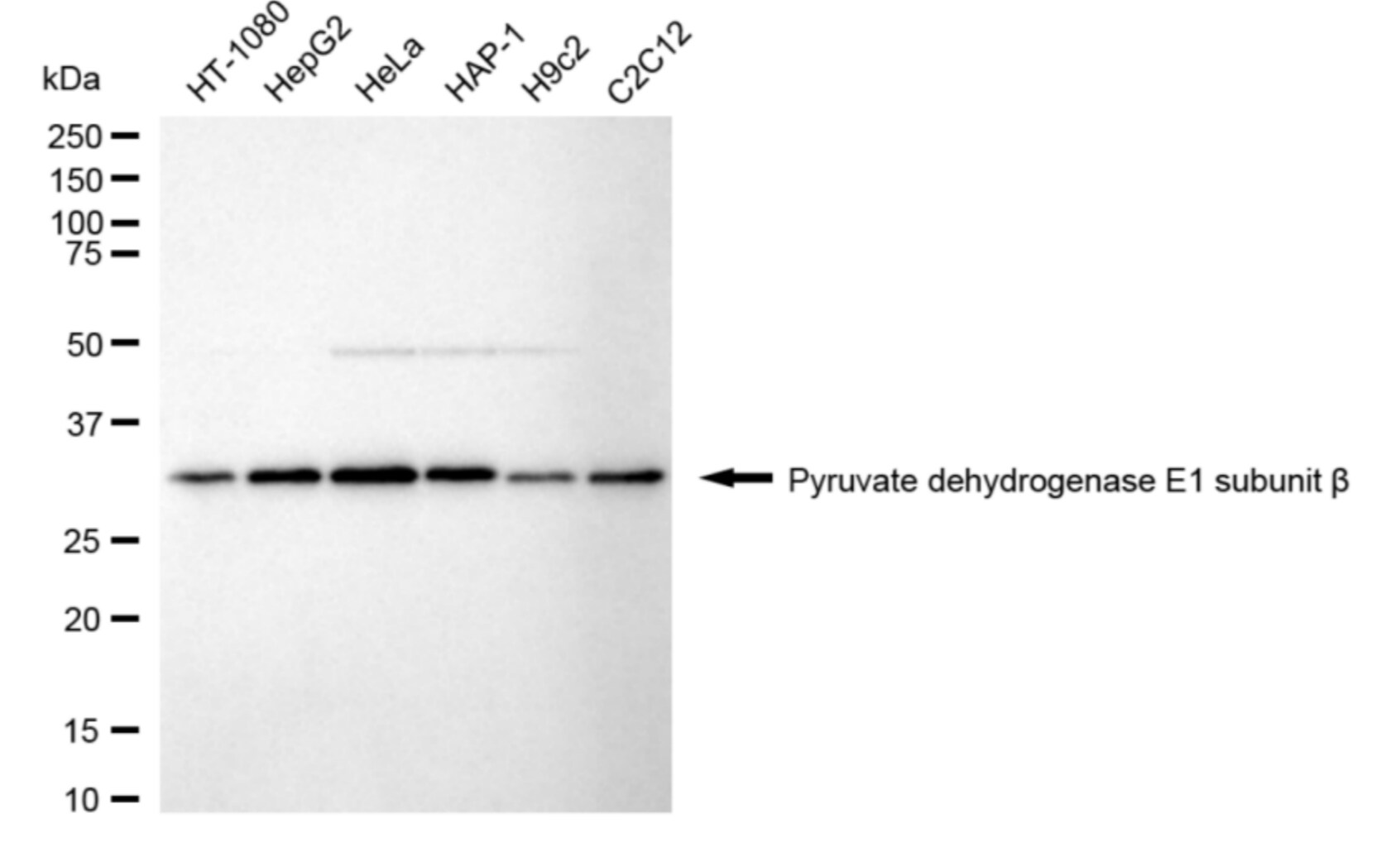 Pyruvate Dehydrogenase E1 beta subunit Antibody (24GB5250)