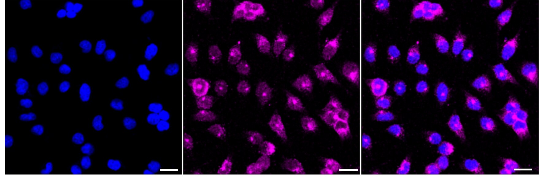 SSX2IP Antibody (24GB5255)