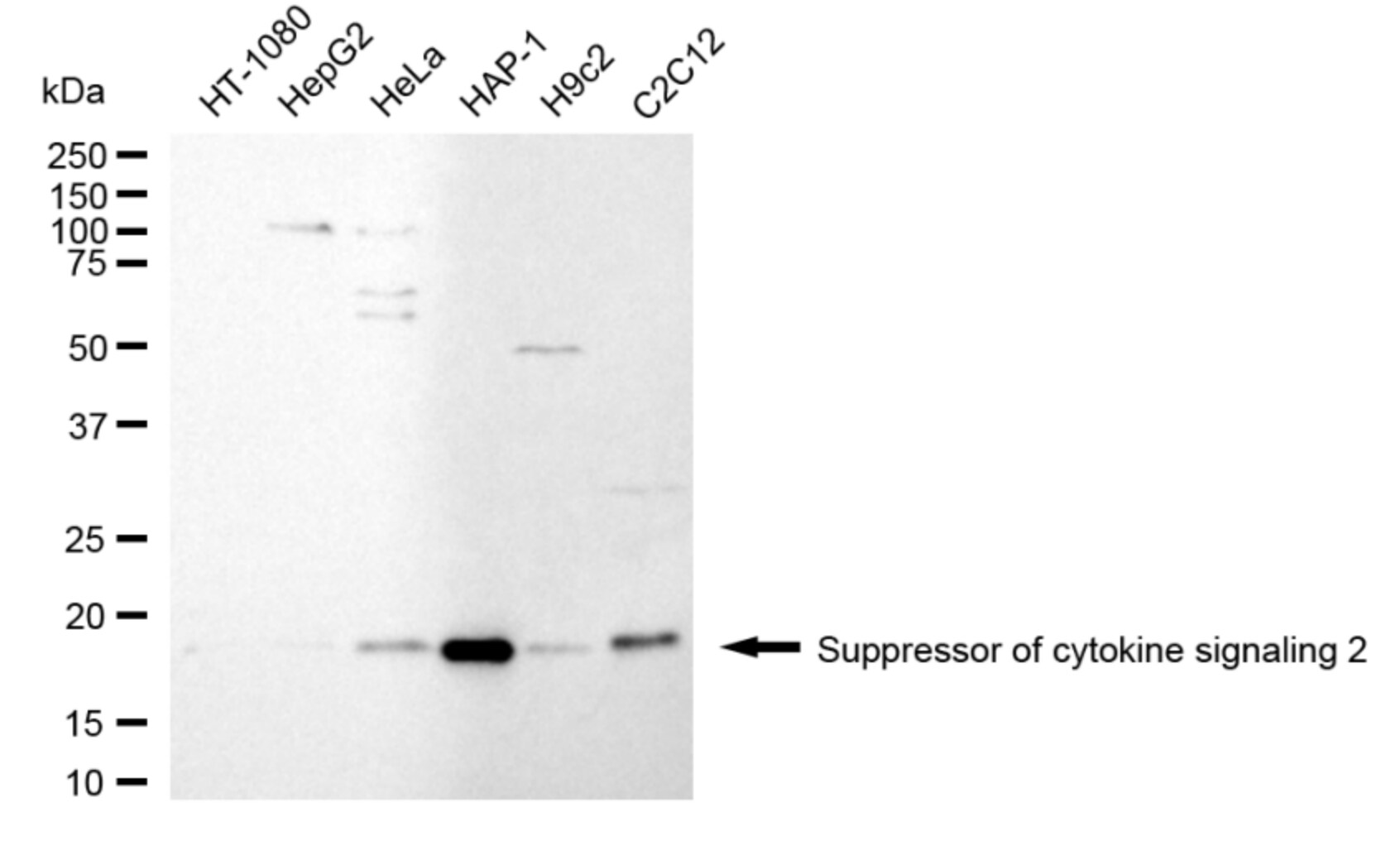 SOCS-2 Antibody (24GB5275)