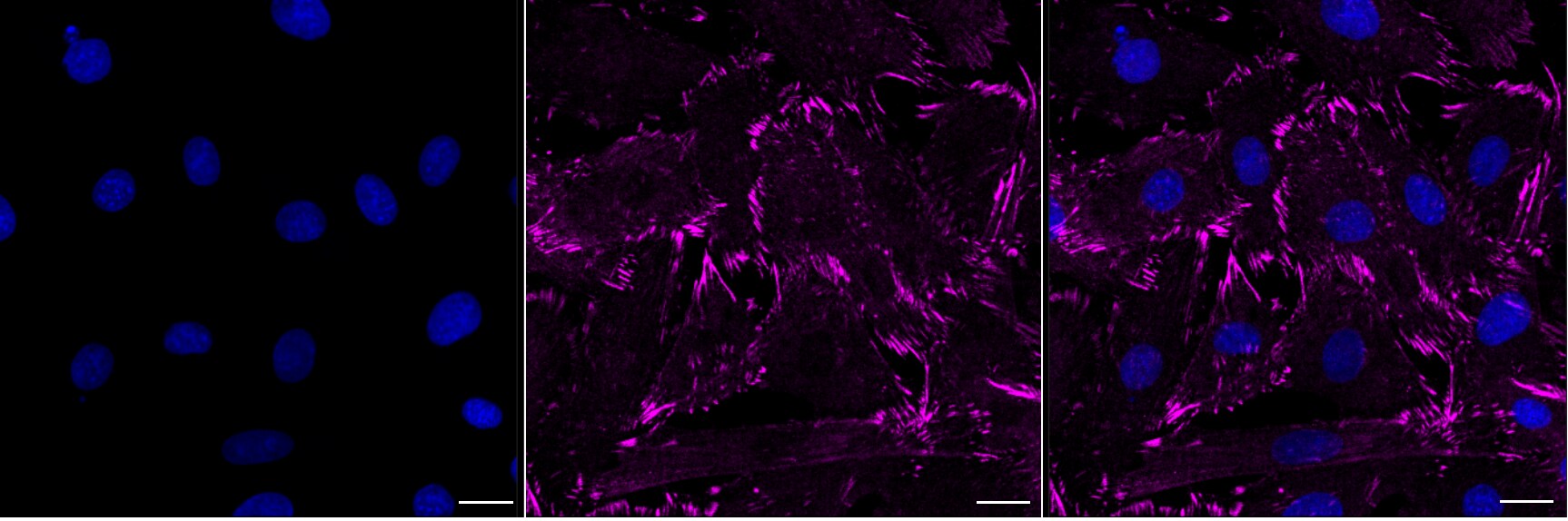Zyxin Antibody (24GB5290)