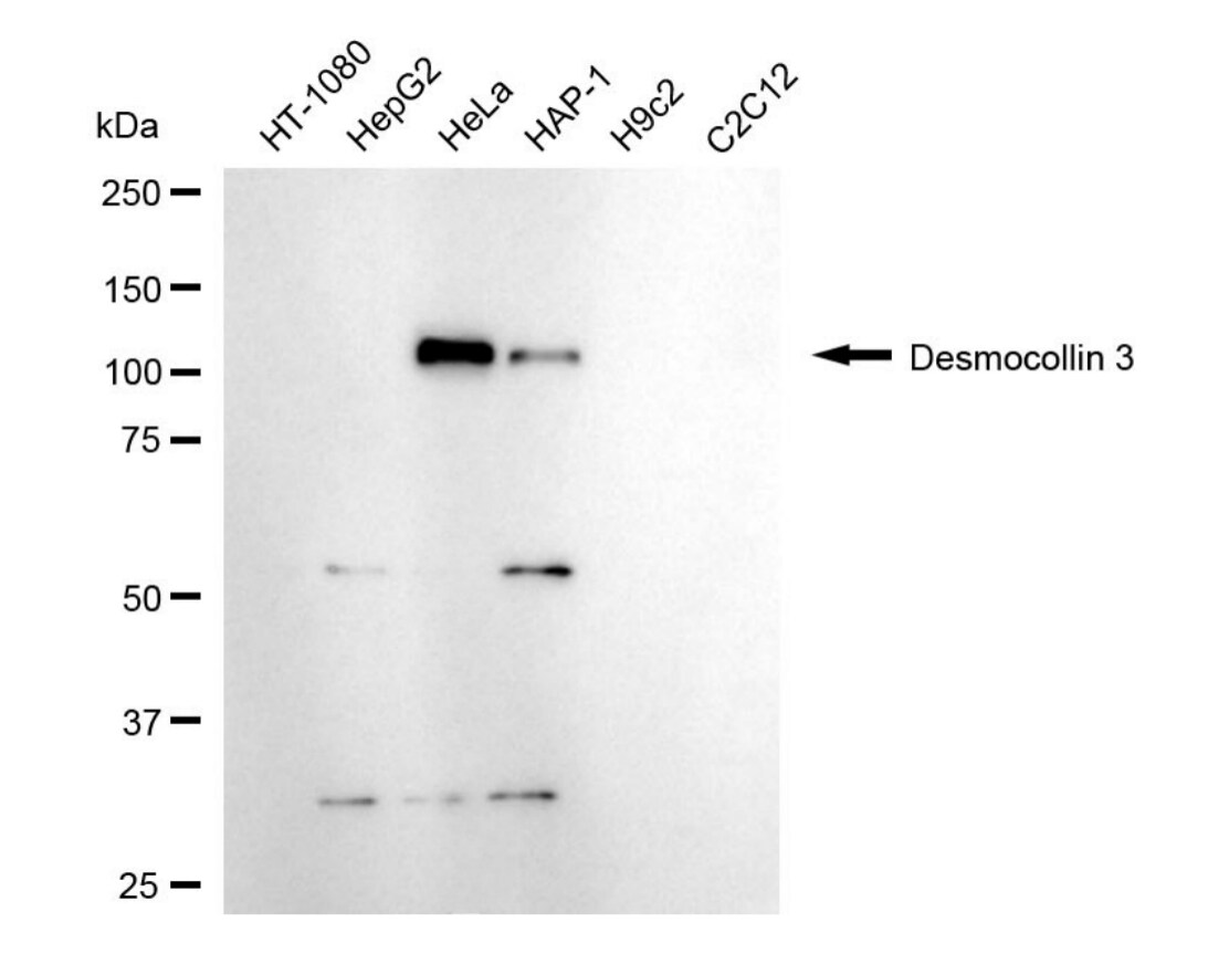 Desmocollin-3 Antibody (24GB5330)