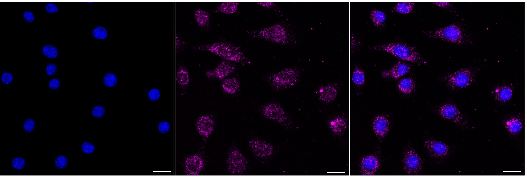 ACOX1 Antibody (24GB5340)