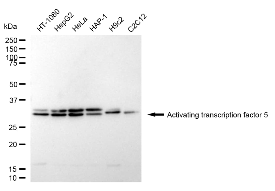 ATF5 Antibody (24GB5345)