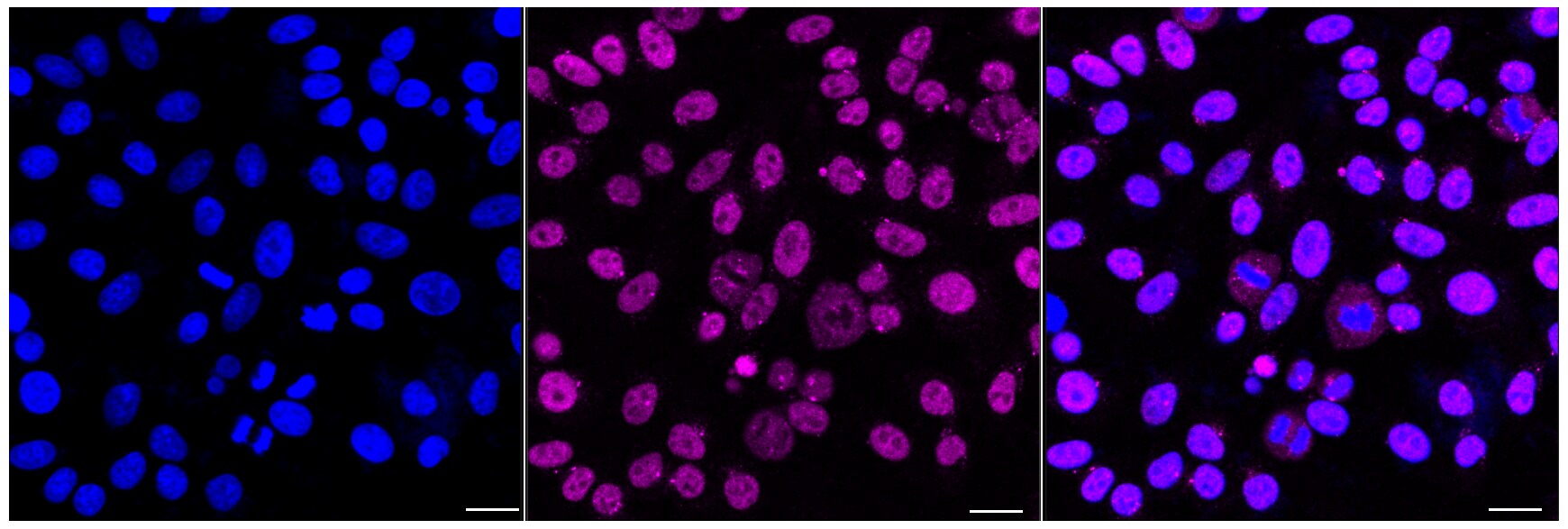 EWSR1 Antibody (24GB5385)