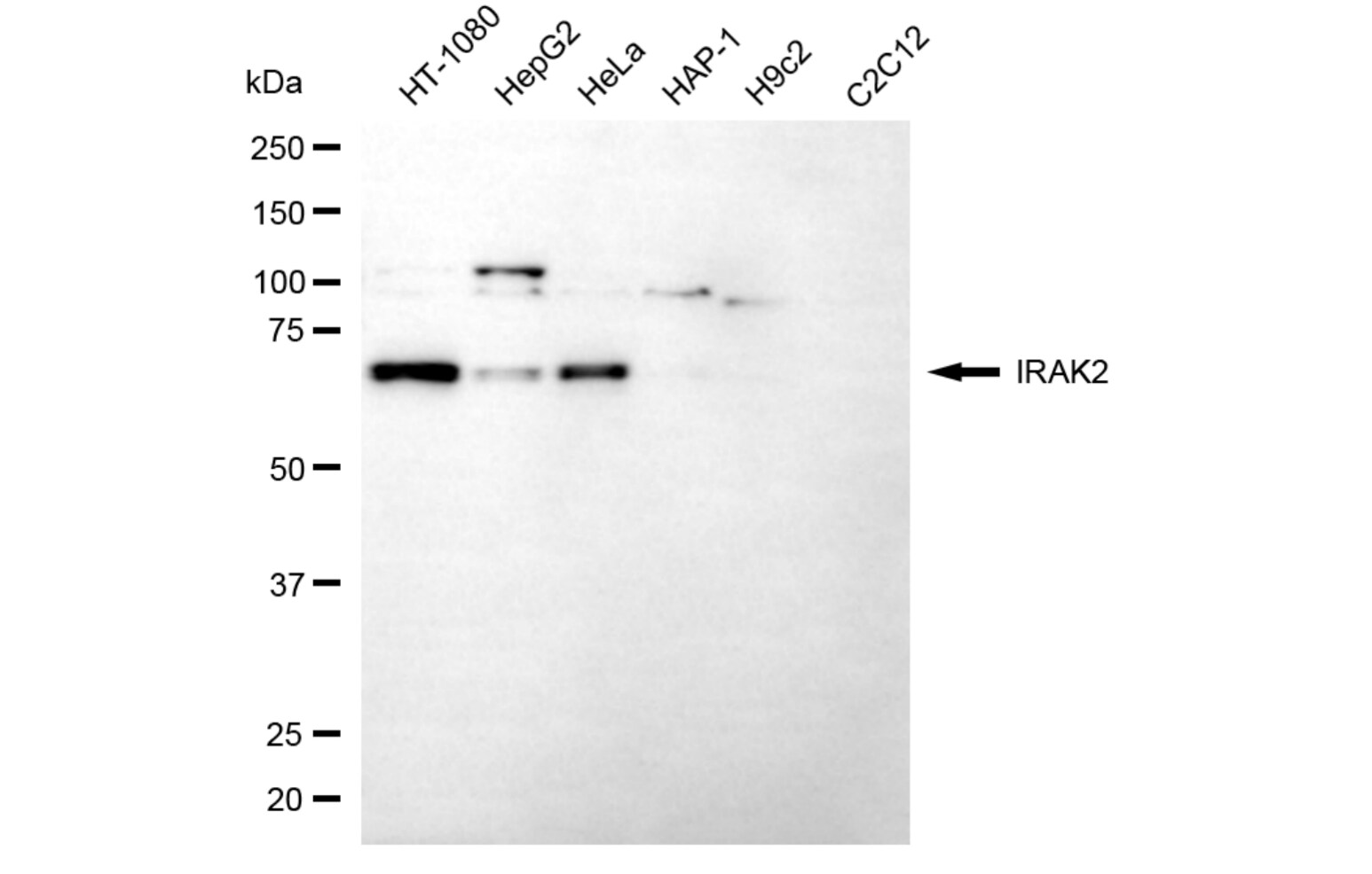 IRAK2 Antibody (24GB5805)