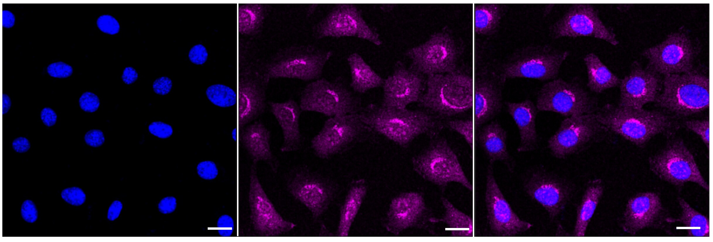 Golgin 97 Antibody (23GB1800)