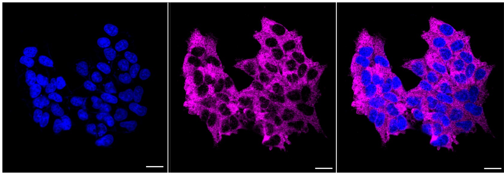 Thyroid receptor-interacting protein 13 Antibody (24GB6625)