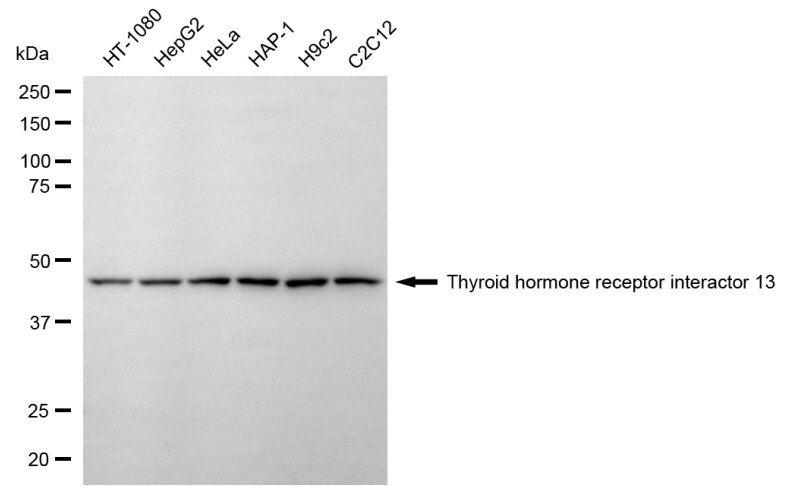 Thyroid receptor-interacting protein 13 Antibody (24GB6625)