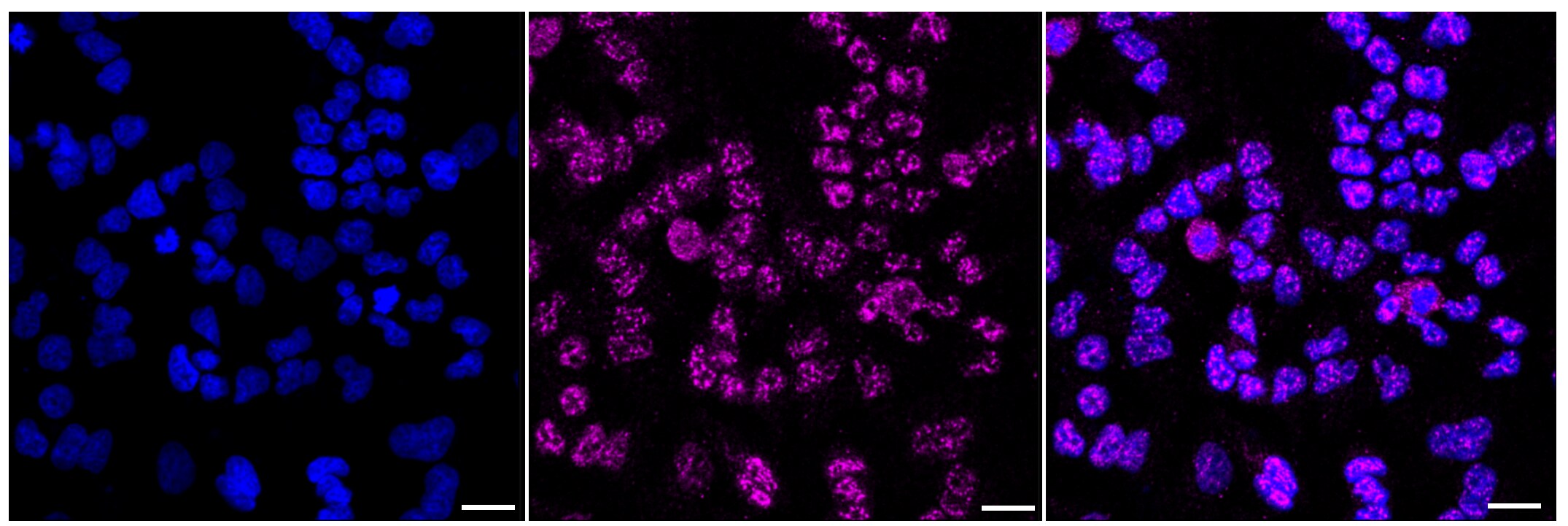 ErbB2/Her2 [p Tyr1139] Antibody (23GB1375)