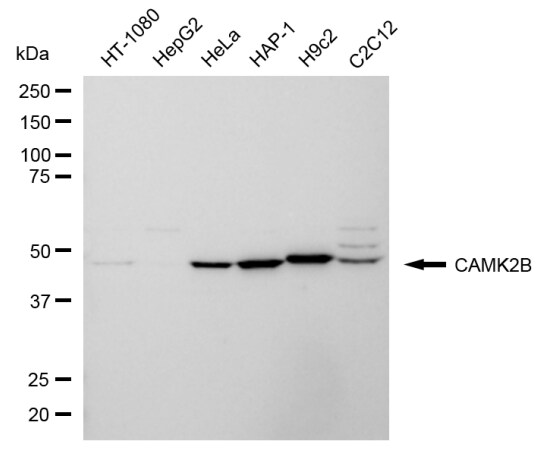 CaMKII beta Antibody (24GB6885)