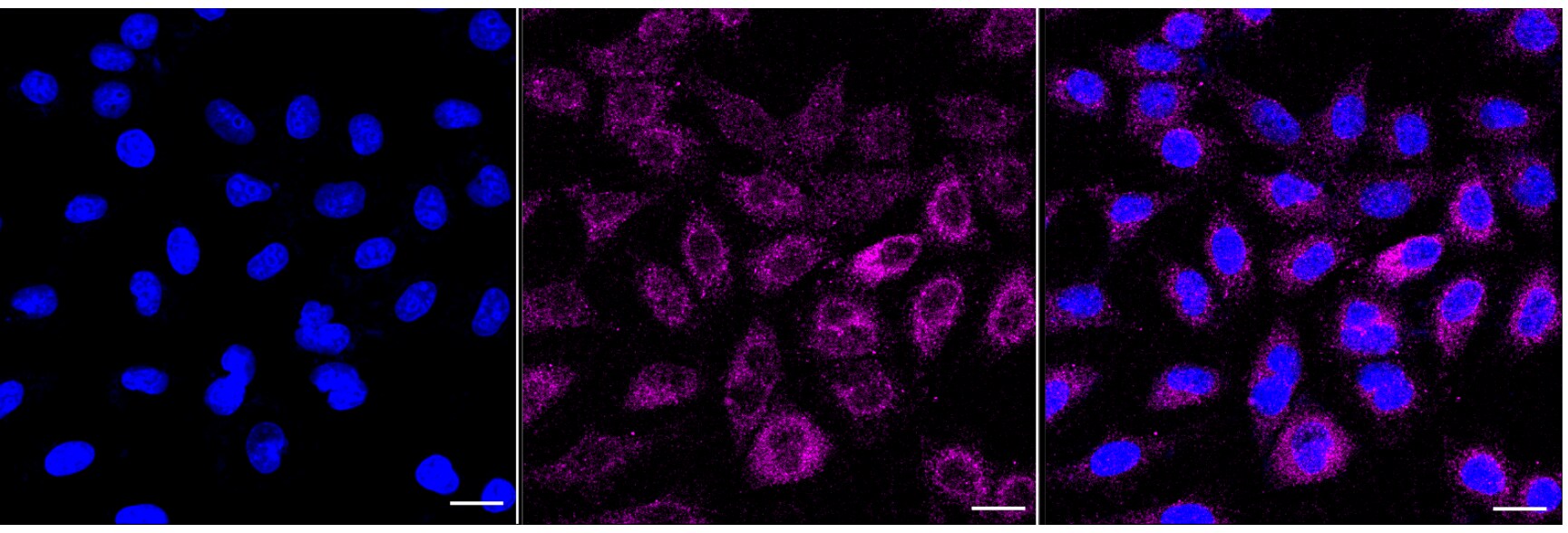 NMDAR2A Antibody (24GB6905)