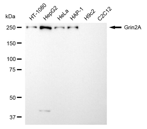 NMDAR2A Antibody (24GB6905)