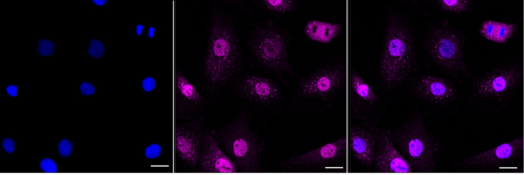 PSD93 Antibody (24GB6970)