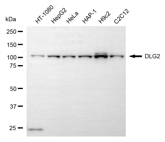 PSD93 Antibody (24GB6970)