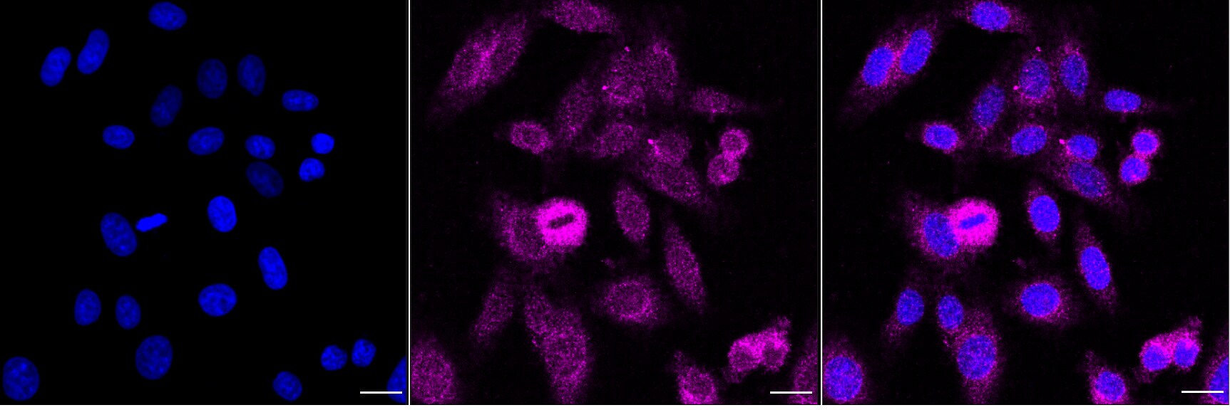 RAB8A Antibody (24GB7040)