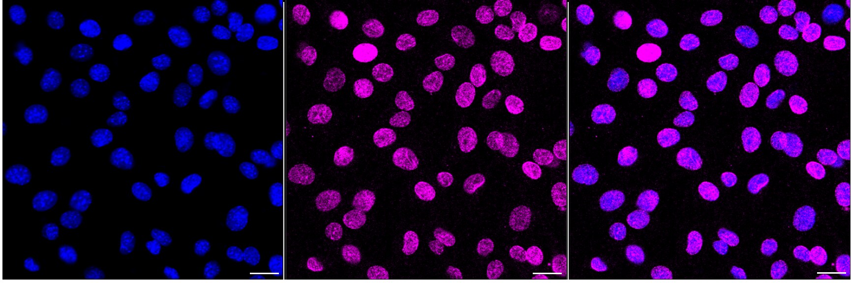 MDM2/HDM2 Antibody (24GB7055)