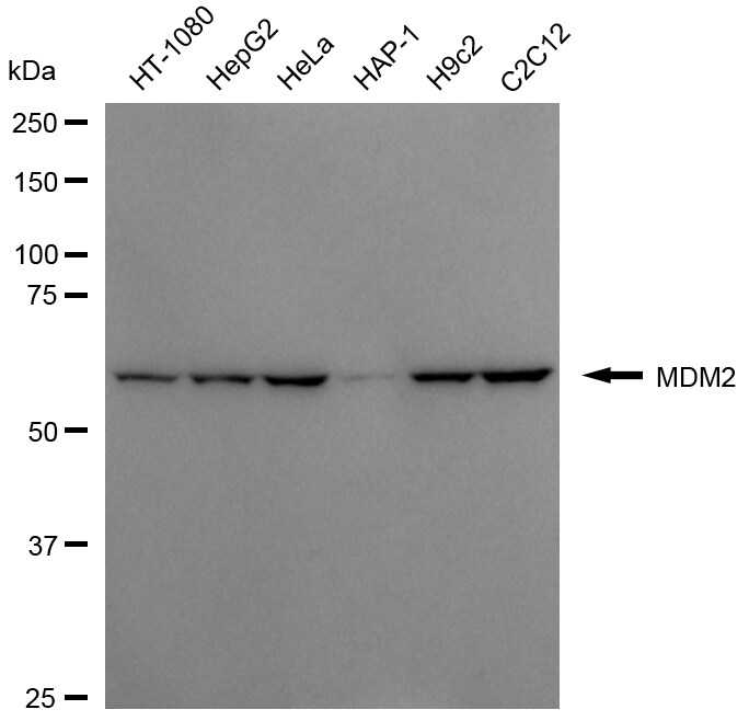 MDM2/HDM2 Antibody (24GB7055)