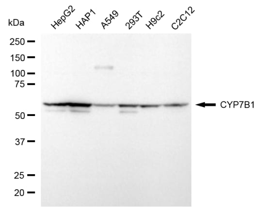 CYP7B1 Antibody (24GB8275)