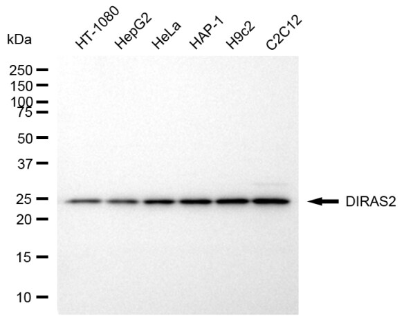 DIRAS2 Antibody (24GB8315)