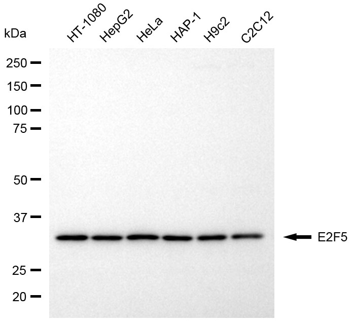 E2F5 Antibody (24GB8325)