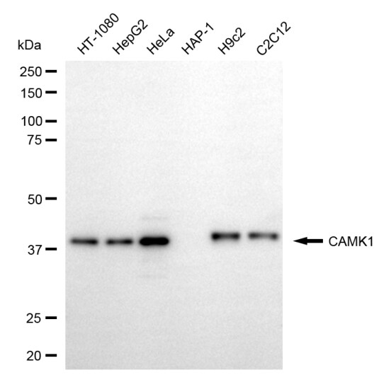 CaM Kinase I Antibody (24GB6790)