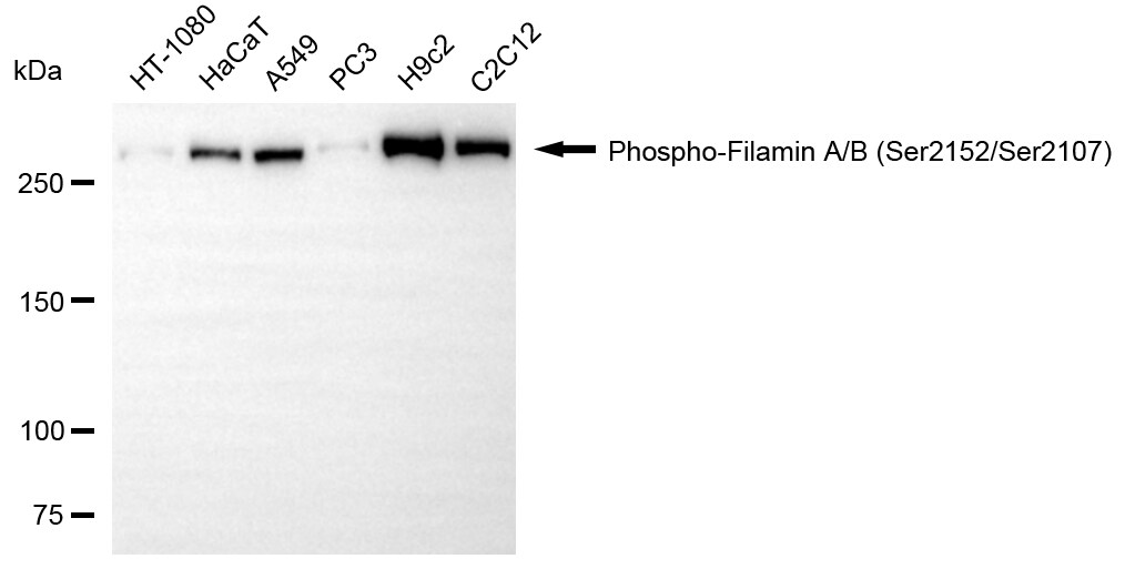 Filamin B [p Ser2152] Antibody (24GB13760)