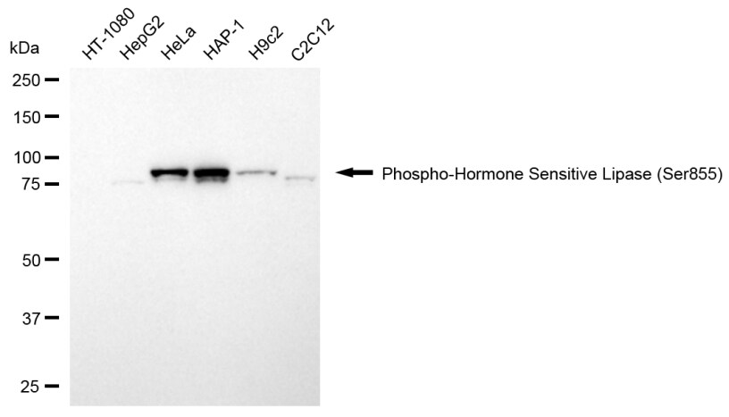 Hormone-sensitive Lipase/HSL [p Ser855] Antibody (24GB13765)