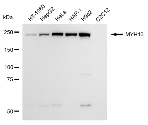 non-muscle heavy chain 10 Myosin Antibody (24GB13790)