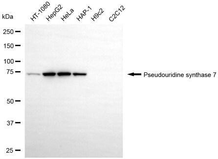 PUS7 Antibody (24GB13935)