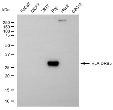 HLA DRB5 Antibody (24GB14135)