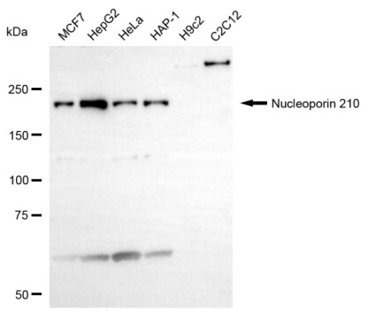 NUP210 Antibody (24GB14140)