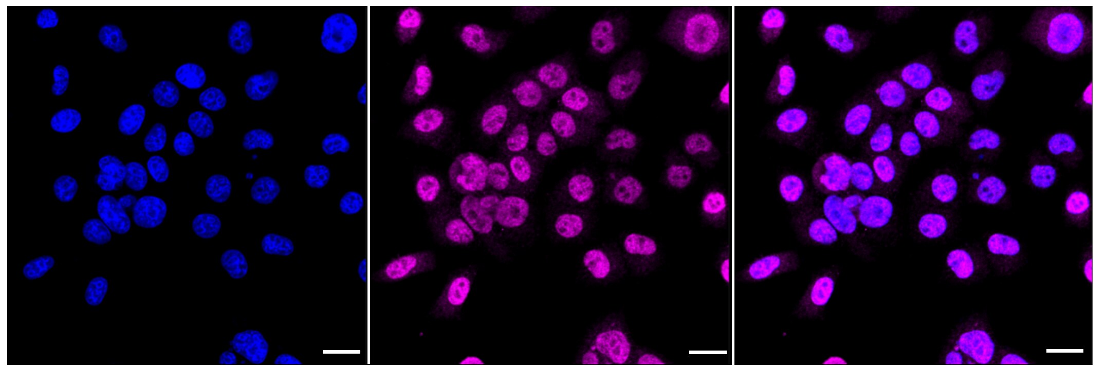IkB-alpha [p Ser32] Antibody (23GB1140)