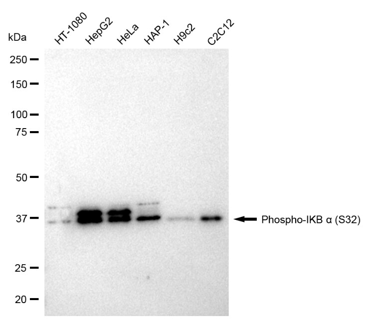 IkB-alpha [p Ser32] Antibody (23GB1140)