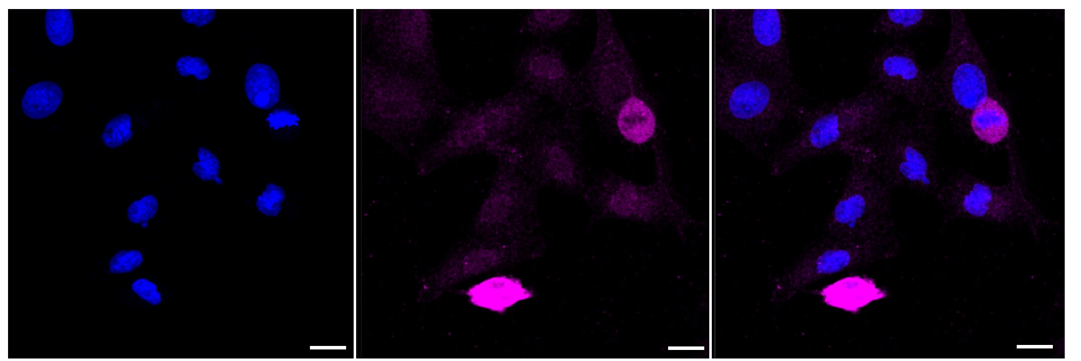 PIK3CA Antibody (23GB950)