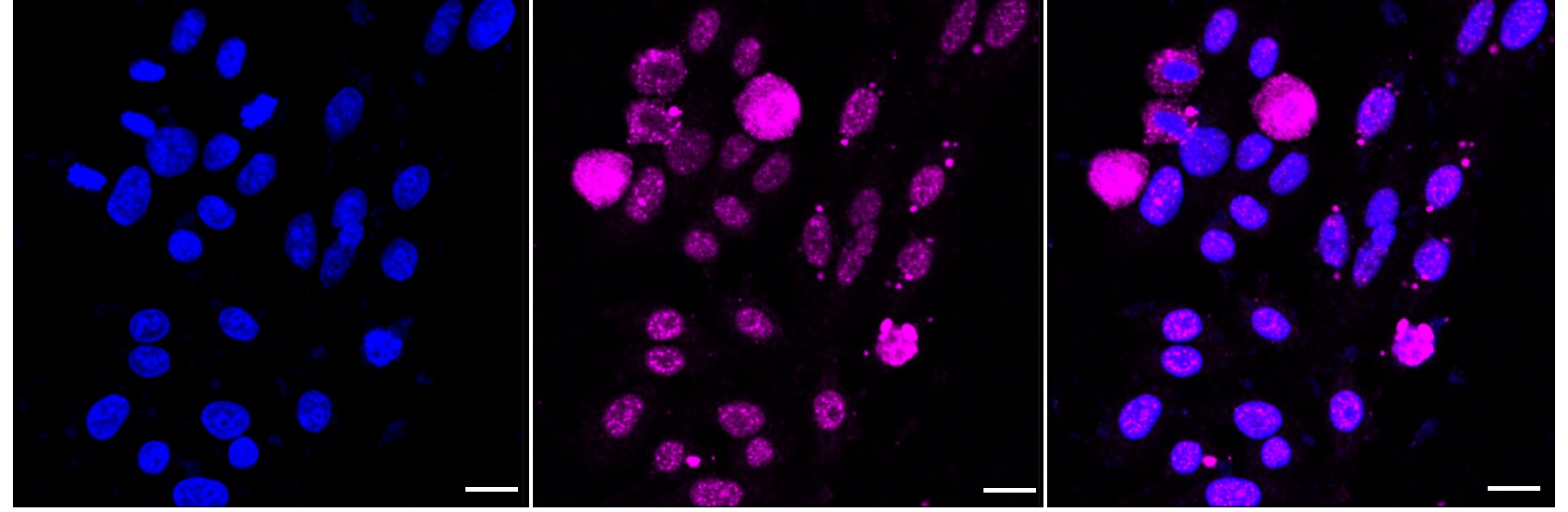 IkB-alpha [p Ser36] Antibody (23GB1300)