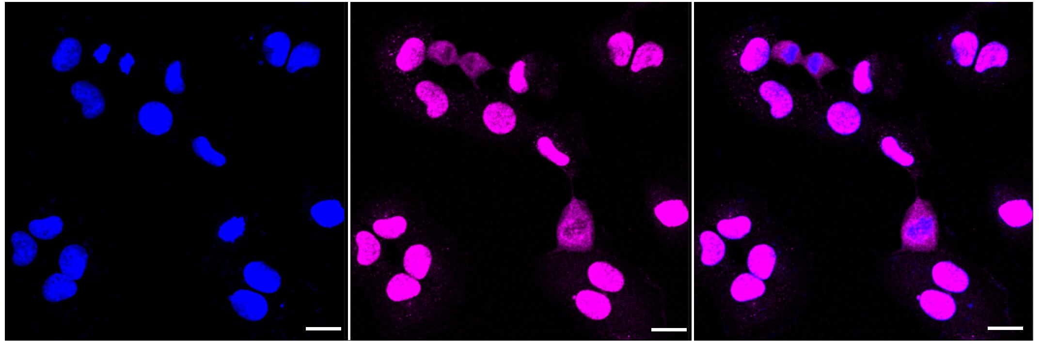 AKT1 [p Thr450] Antibody (23GB1780)