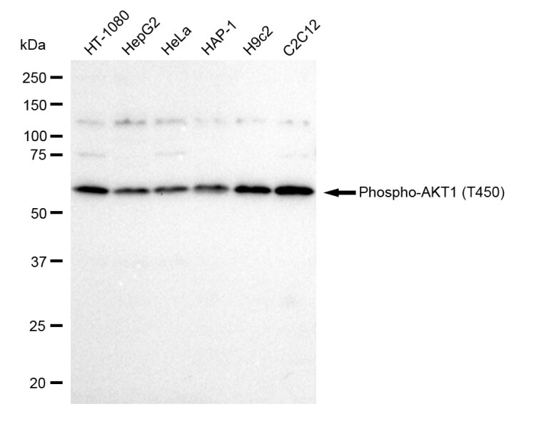 AKT1 [p Thr450] Antibody (23GB1780)