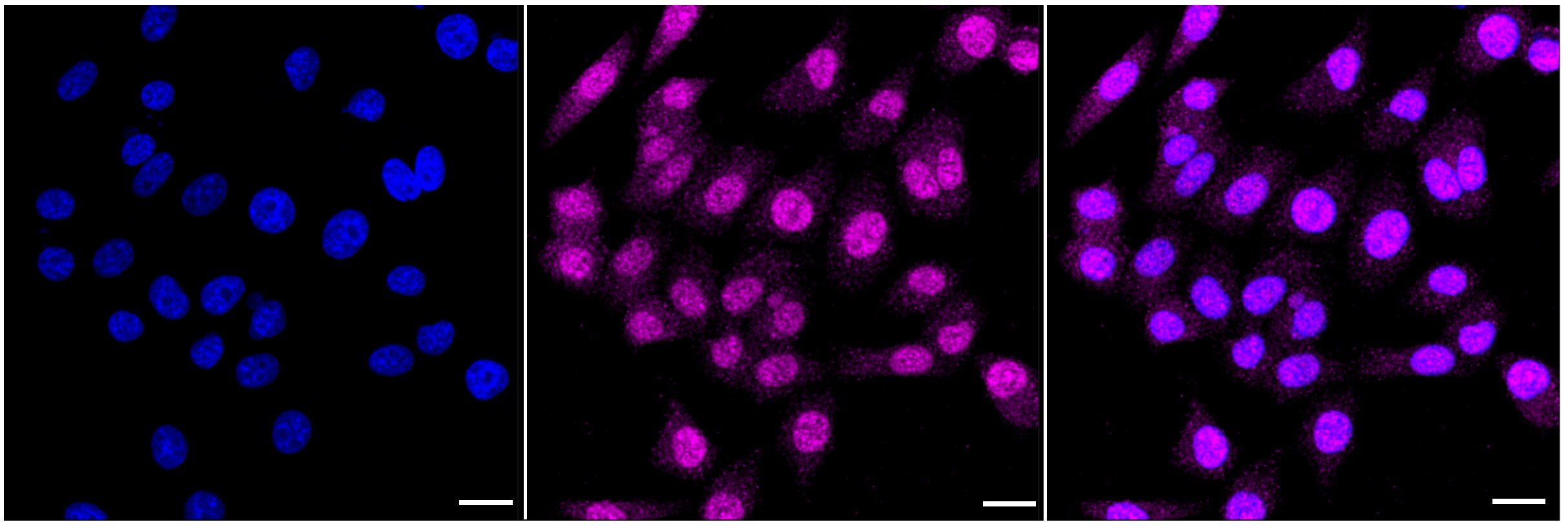 Angiopoietin-1 Antibody (23GB1775)